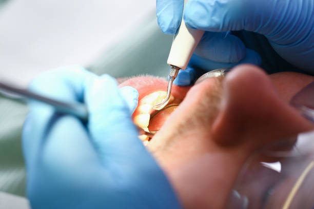 Best Broken or Cracked Tooth Emergency Dentist in Weldon, CA