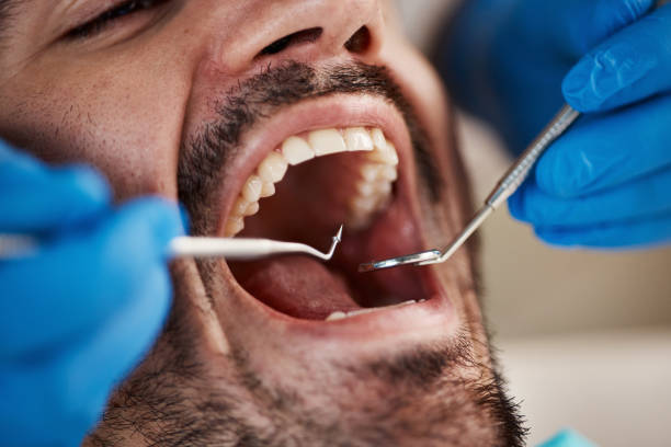 Best Pediatric Emergency Dentist in Weldon, CA